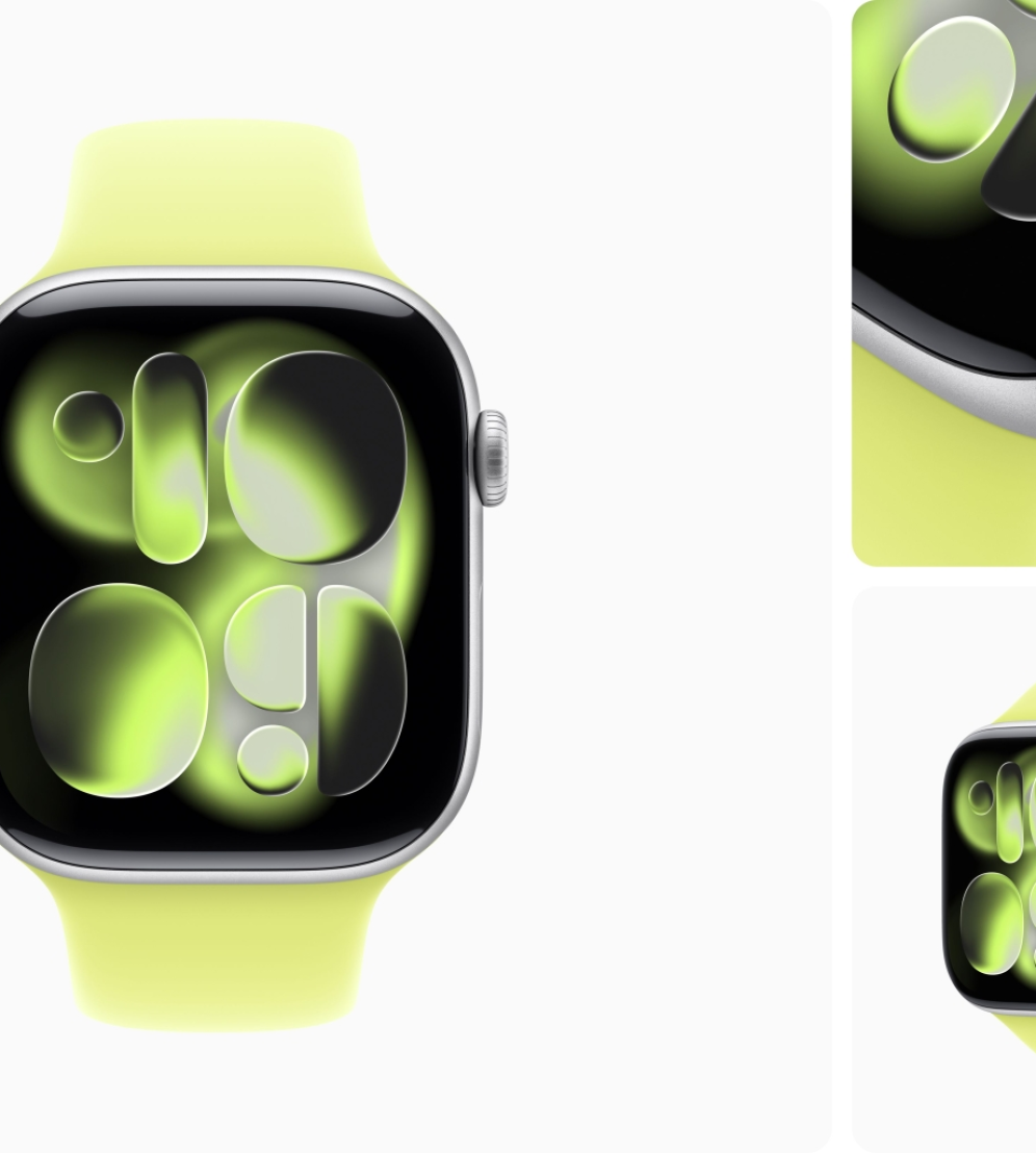 Apple Watch S11 42mm viền nhôm