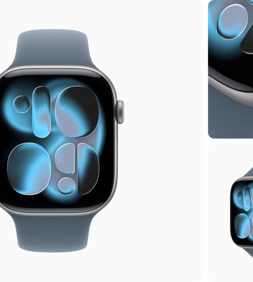 Apple Watch S11 46mm Viền Nhôm
